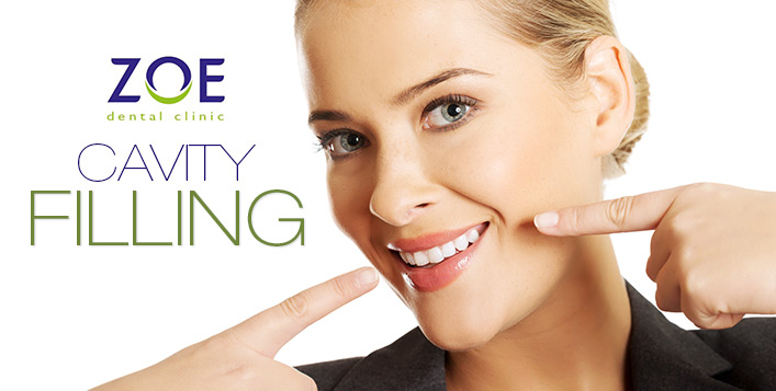 Cavity filling for one or two teeth