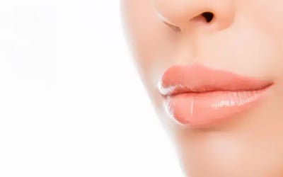 74% OFF on Laser Lip Depigmentation at Ahaleena Medical | Cobone