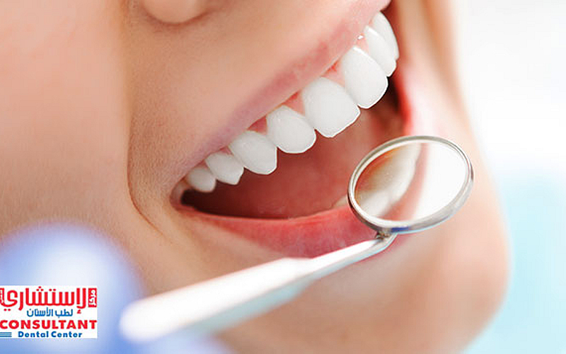 المركز الإستشاري لطب الأسنان