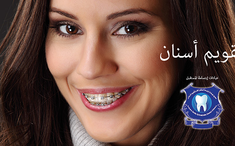 تقويم أسنان وتنظيف وتلميع