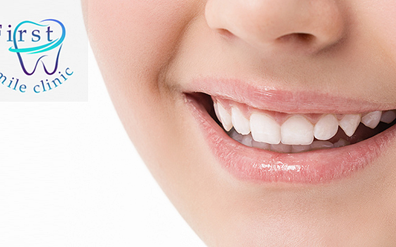 Cleaning, filling, whitening & more