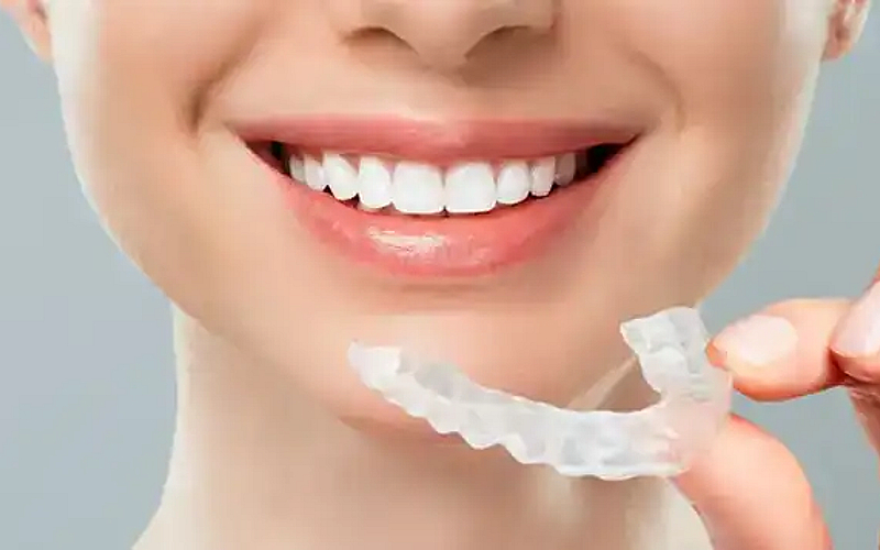 مع استشارة طبية وفتح ملف!