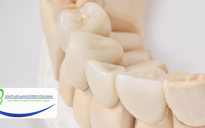 مجمع عيادات العلاج التخصصي لطب الأسنان