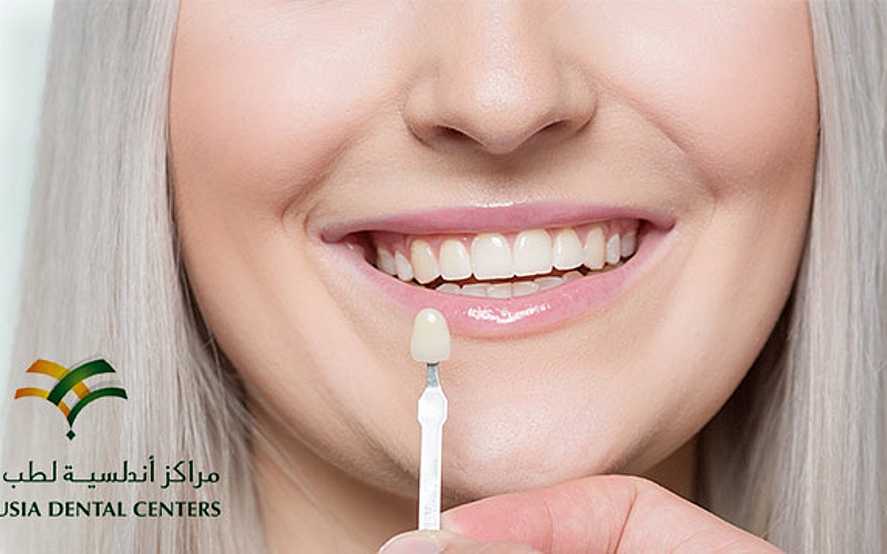 مركز أندلسية لطب الاسنان فرع المكرونة