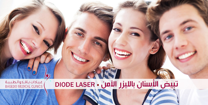 Laser Teeth whitening