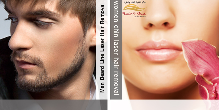 Beard Laser Trim And Chin Hair Removal