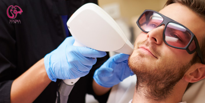 Beard Shaping Laser Session For Men Cobone Offers