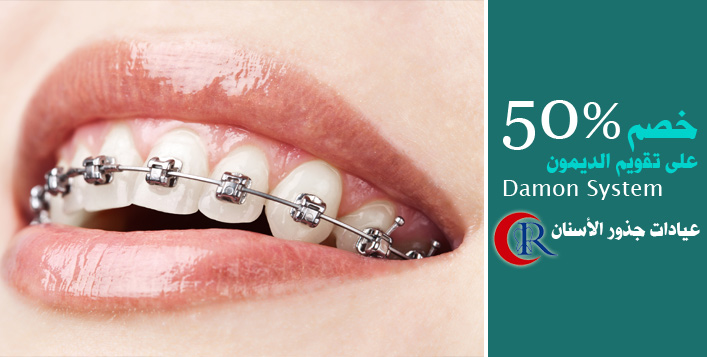 خصم 50 على تقويم الديمون كوبون