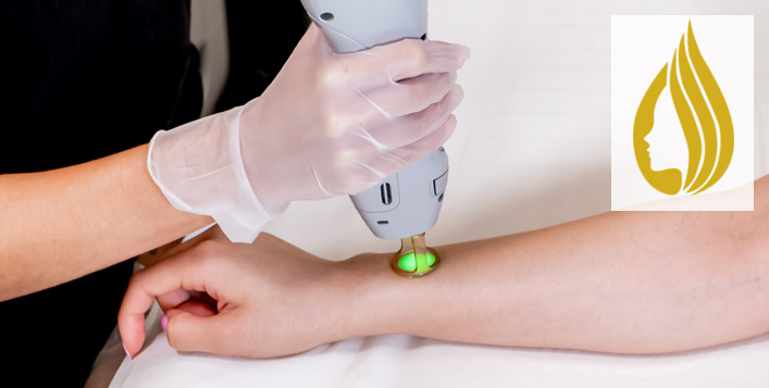 ازالة الشعر بالكهرباء في الرياض