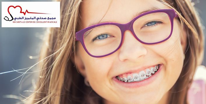 تقويم الأسنان في مجمع صحتي المتميز الطبي مقابل 499 ر س كوبون