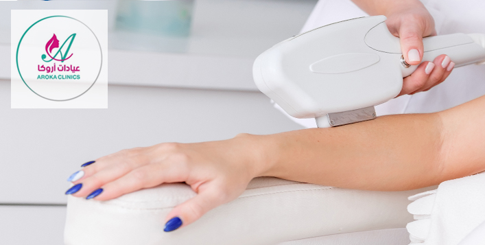 Laser hair removal deals Clearance