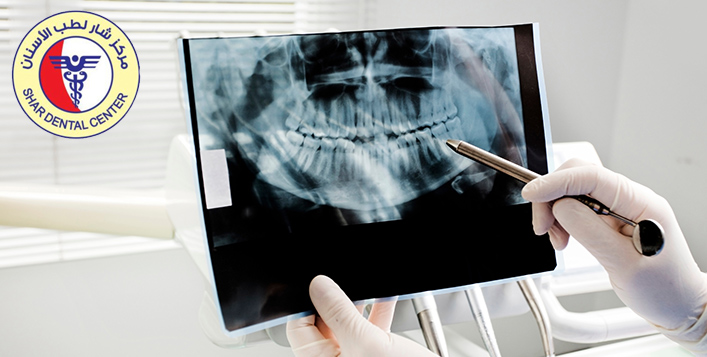 Dental x ray near me