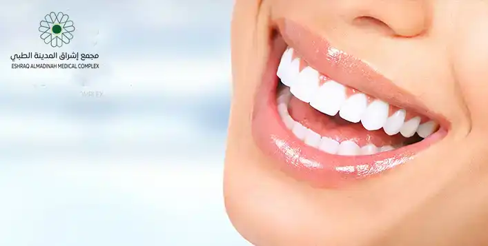 Cleaning, whitening, or Hollywood smile!