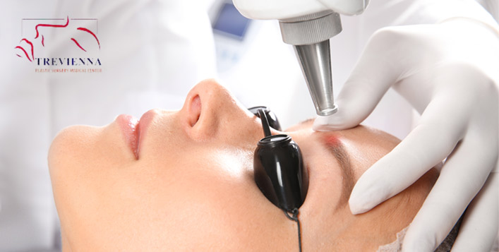 جلسة تشقير الحواجب مجمع تريڨينا الطبي كوبون