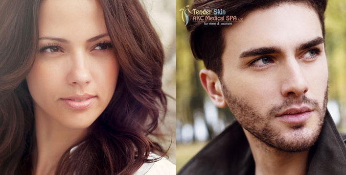 Treat Acne with Micromesotherapy